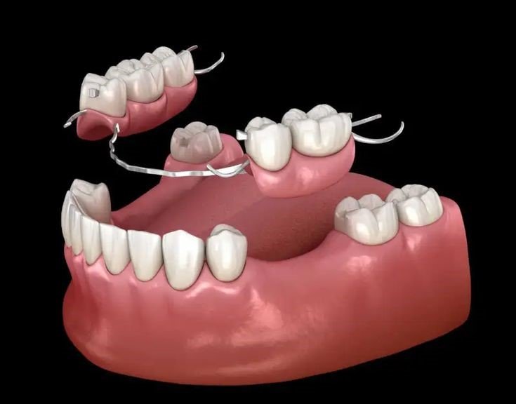Denture