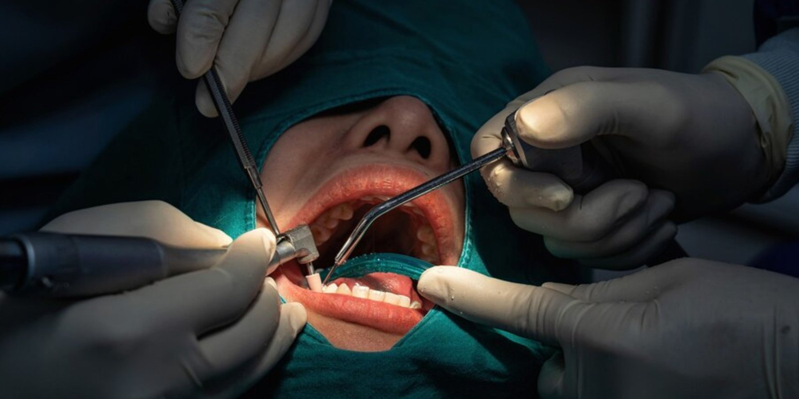Oral+Surgery