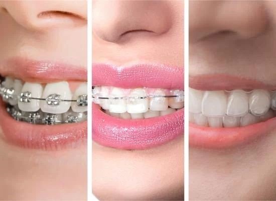 Orthodontic